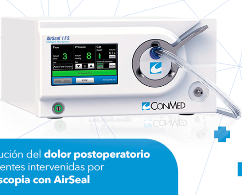 disminucion del dolor con airseal